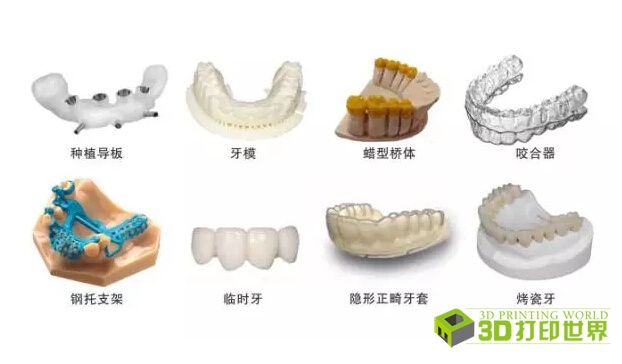 浙江迅实成功并购智维科技 瞄准齿科3D打印